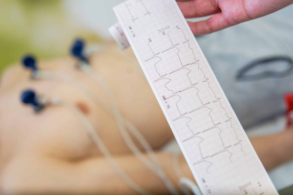 Electrocardiograma